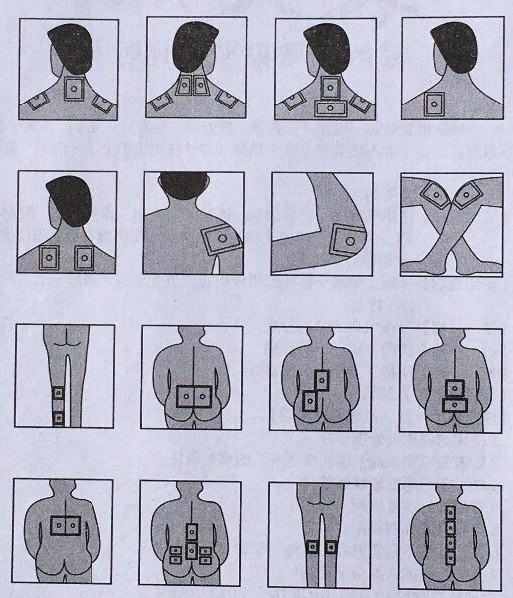 как правильно клеить пластырь-1.jpg